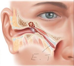 What does it mean when it sounds like air in your ear?