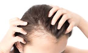 major causes of hair loss